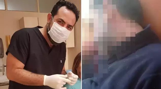 He hit the dentist on the head and sent the moments of his struggle for life to his mother.