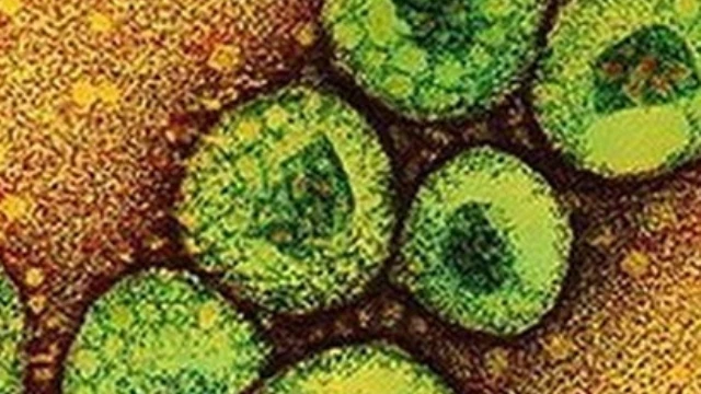 12 New Mers Cases In Abu Dhabi