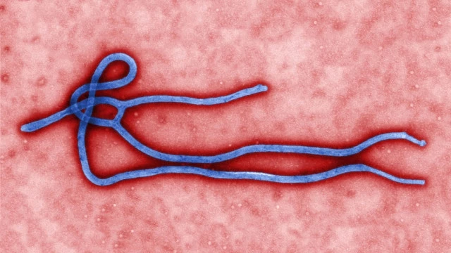 WHO: Ebola Spread In Western Pacific Would Have 'Huge Consequences'
