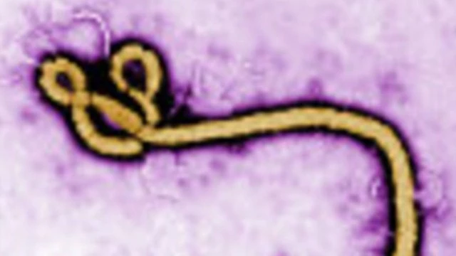 В США разработаны и одобрены два новых теста для выявления вируса Эбола