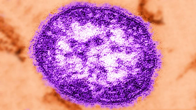 Berlin Measles Epidemic Reaches New High