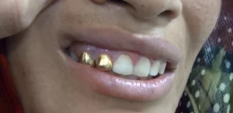 Antep'te Altın Dişli, Son Model Telefonlu Dilenciler Şaşkına Çevirdi