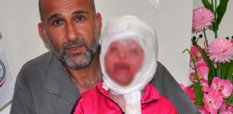 Suriyeli Minik Ayşe'nin Sağlığına Kavuşmak İstiyor