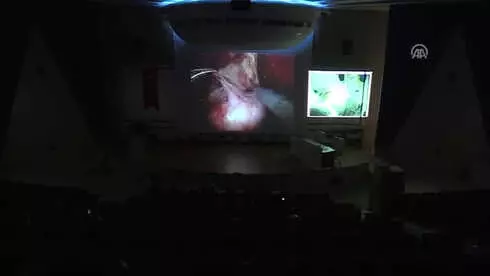 Canlı Yayında Robotla Prostat Kanseri ve Böbrek Genişliği ...