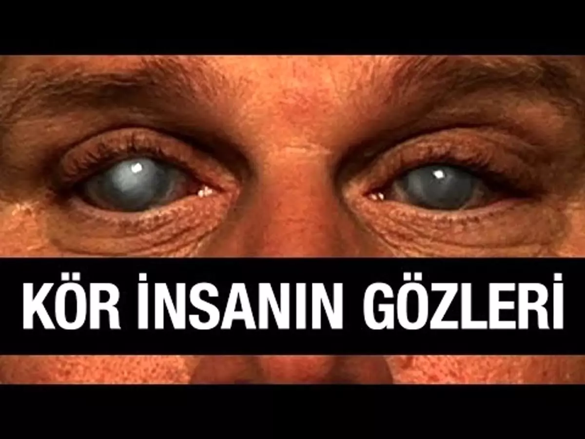 Körler Gözünü Açabilir Mi? Körler Gözünü Açabilir Mi?