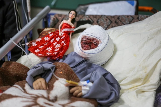 غزة.. بشاعة القصف تستهدف وجه الطفلة سجى