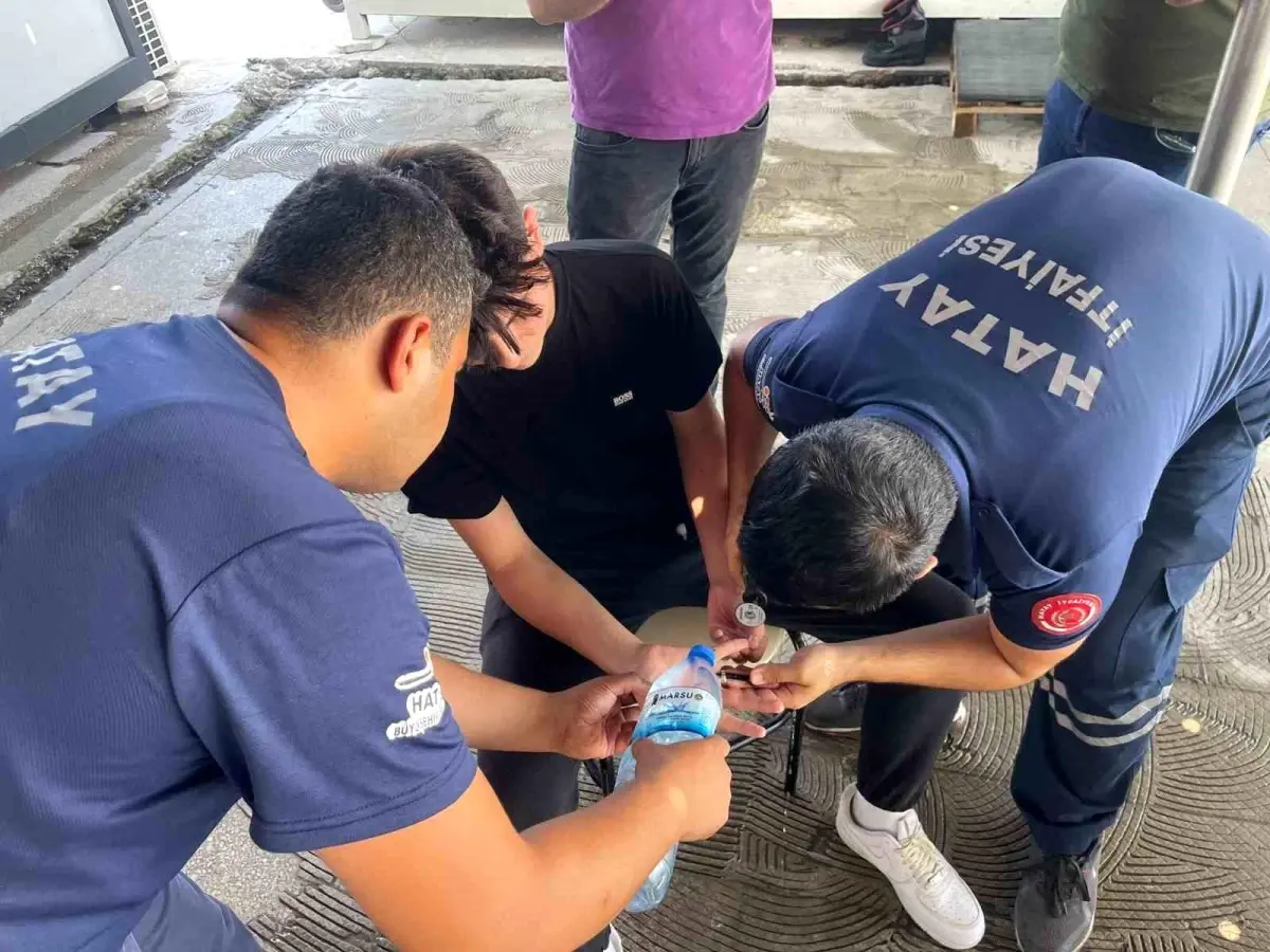 Hatay da Vatandaşın Parmaklarına Sıkışan Yüzük İtfaiye Tarafından