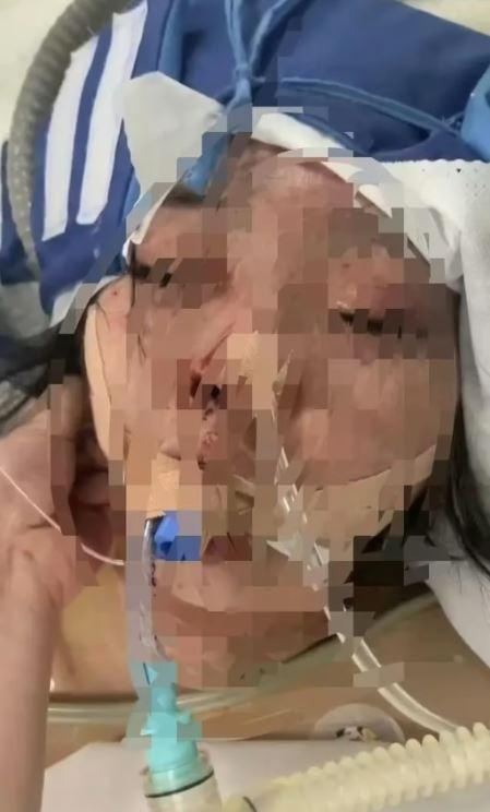 Gaming-addicted husband in China blinds his wife by beating her for not giving him money for games