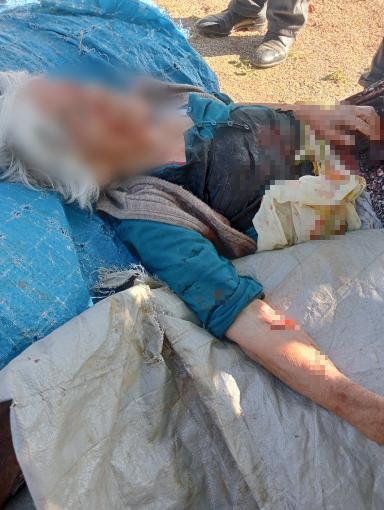 The 78-year-old woman attacked by a stray dog in Niğde was seriously injured