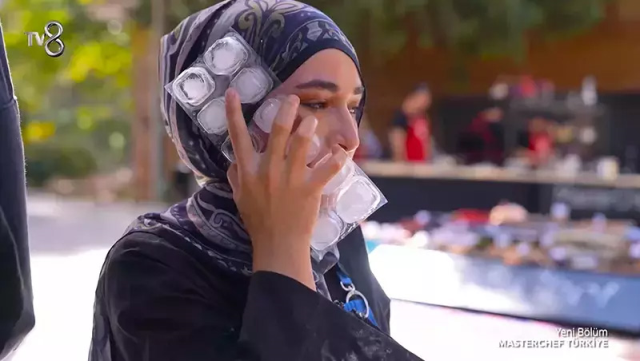 News about Beyza, who burned her face in MasterChef