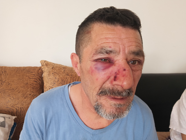 The landlord, who could not raise the rent he wanted, brutally assaulted his tenant and her daughter