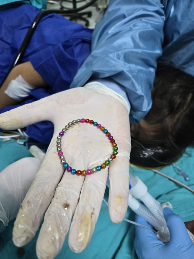 38 magnets were removed from the 5-year-old child's intestine