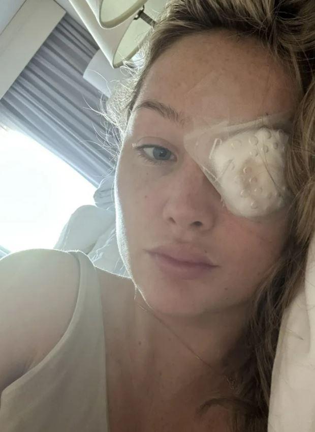 She suffered permanent vision loss in her left eye after being struck by the metal strap of a bag