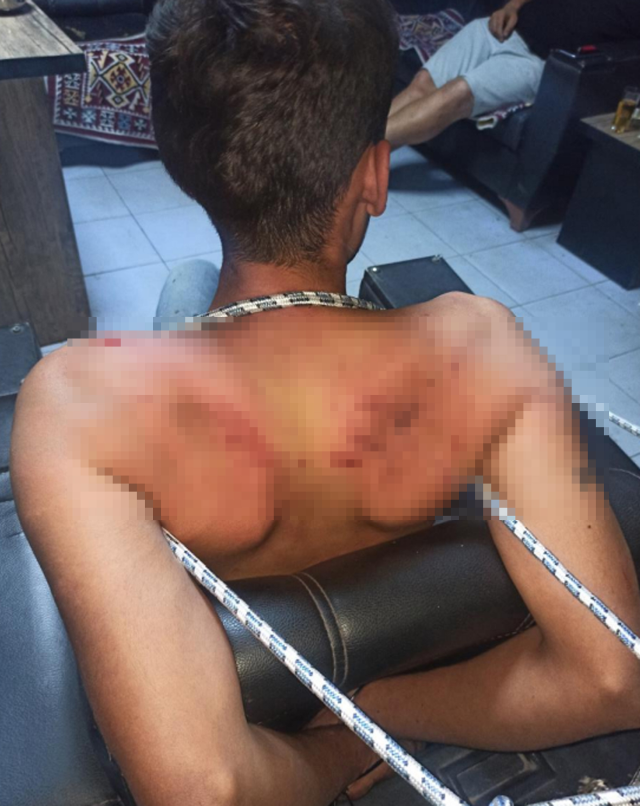 The person who was tortured for 3 days: 11 hearings were held, the criminals should be punished