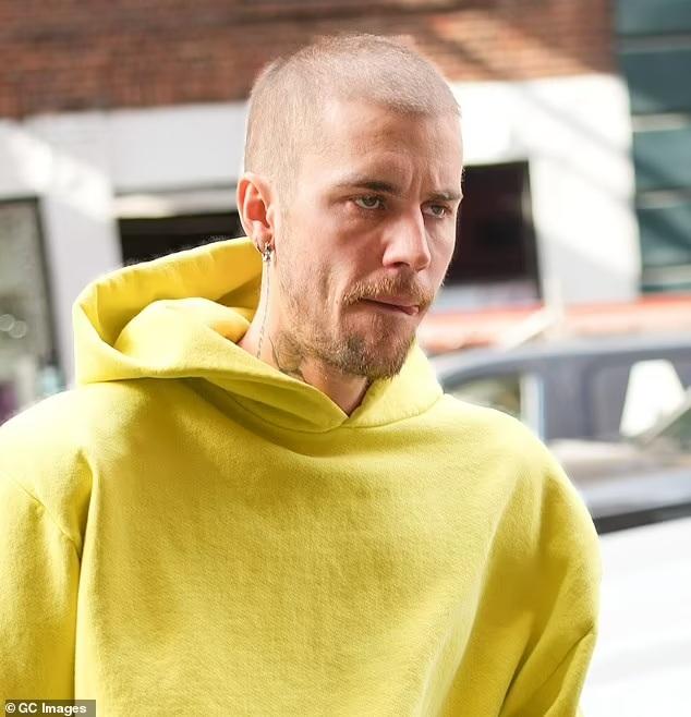 Justin Bieber's latest appearance has worried his fans