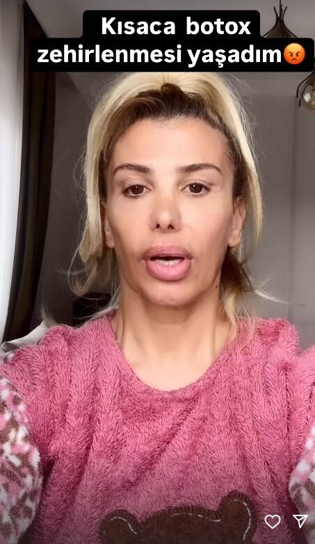 The face of singer Hatice, who had Botox, has become unrecognizable