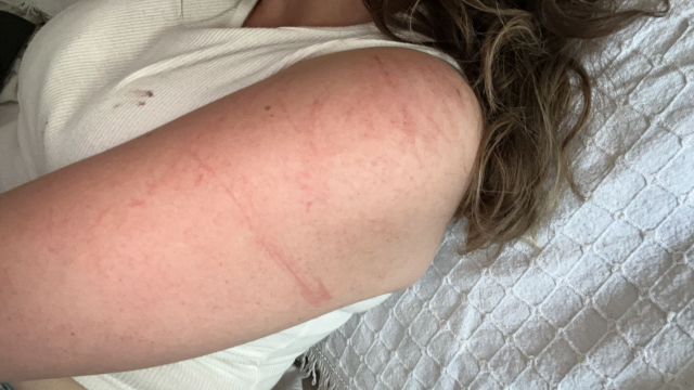 A Woman Who Was Attacked with a Knife in Bursa Survived