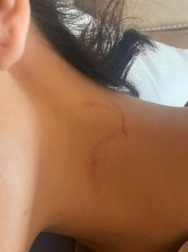 Can Yaman's girlfriend Sara Bluma revealed that she was subjected to violence