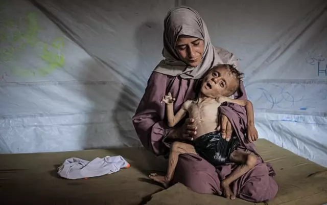 The heartbreaking story of a child wrapped in a plastic bag instead of a diaper, on the brink of starvation