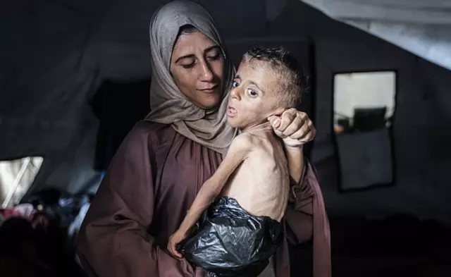 The heartbreaking story of a child wrapped in a plastic bag instead of a diaper, on the brink of starvation