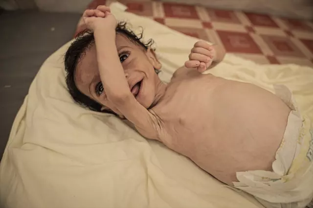 6 more people died of hunger in 24 hours, 7-month-old baby Salim's life is in danger