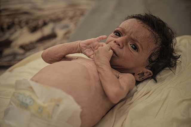 6 more people died of hunger in 24 hours, 7-month-old baby Salim's life is in danger