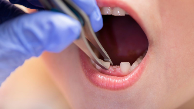 A drug that will regrow teeth has been developed! The release date has been announced