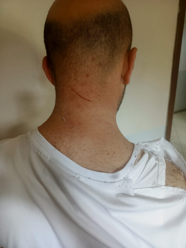 Women attacked the father going to see his child with a stick