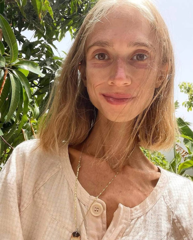 The social media influencer who lost up to 20 kilos with a fruit diet has passed away