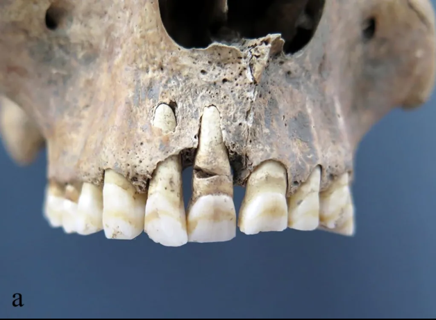 Archaeologists found 1,800-year-old bodies in an ancient well