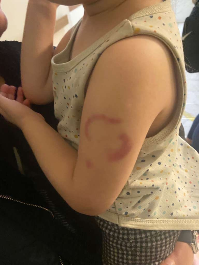 The teacher accused of biting his student's arm was arrested