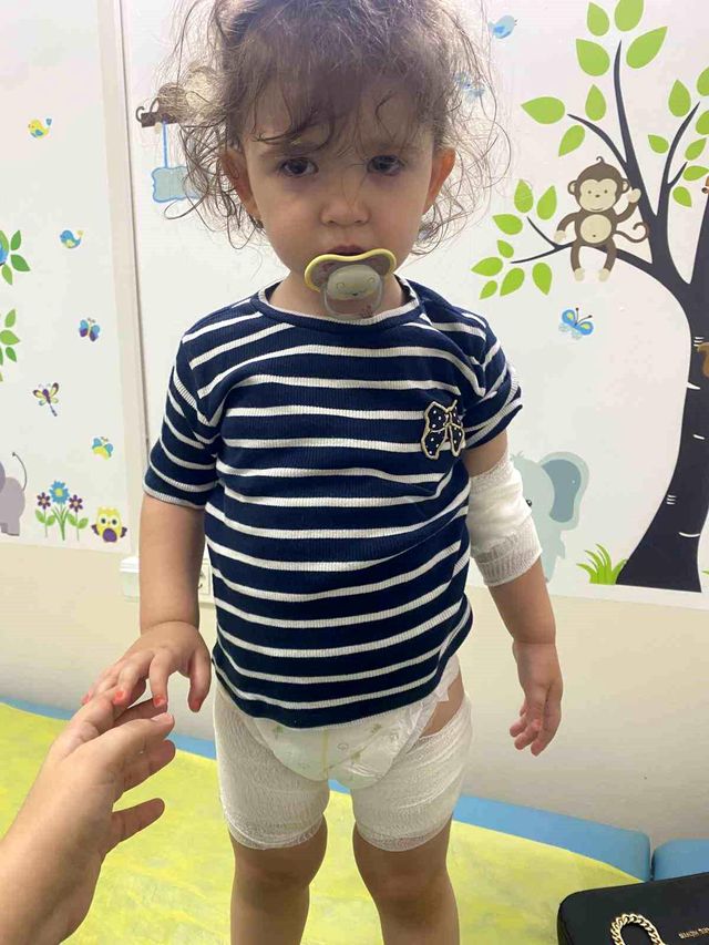 injured child