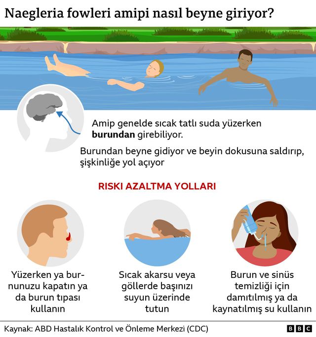 Brain-Eating Amoeba Cases Rising Worldwide