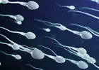 Sperm sayısı normal ama gebelik neden olmuyor? Sperm DNA hasarı nedir?