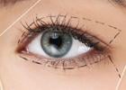 Bella Eyes mı, blefaroplasti mi? Göz estetiğinde karar anı