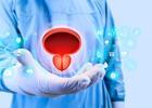 Prostat tedavisinde minimal müdahale, maksimum konfor