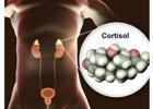 Kortizol Yüksekliğinde Kalori Kısmak Neden İşe Yaramıyor?