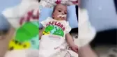 Barış Bebeği Yaşatmak Için Mücadele Ediyorlar