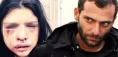 Onur Özbizerdik'in Eski Sevgilisi İfade Değiştirdi: Burnumu da Onur Kırdı