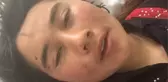 Kocasının Kulaklarını Kestiği Kadın Dehşet Anlarını Anlattı
