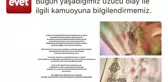 Antalya İl Başkanı Rıza Sümer, Paylaştığı Yırtık Başörtüyle Saldırıyı Kınadı