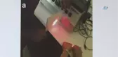 Yerli ve Milli Lazer Cihazı ile 4 Ayrı Hastalık Tedavi Ediliyor