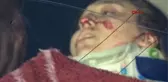 Bursa Yaralı Anne Kaza Sonrası Oğlunu Sayıkladı