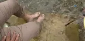 Yurt İçi ve Yurt Dışından Gelen Hastalar Sivas'a Akın Ediyor... Doktor Balıklar Sırrını Koruyor