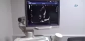 Sıcaklar Artıyor, Uzmanlar Uyarıyor