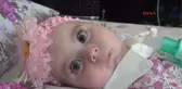 Manisa - Sma Hastası Zeynep Bebek, Yaşama Tutunamadı
