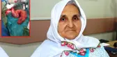 Karnından Çıkana Doktorlar Bile İnanamadı: Lastik Büyüklüğünde Tıkanmış Bağırsak