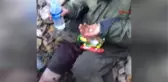 Tunceli Mehmetçik Yaralanıp Teslim Olan PKK'lı Kadın Teröristi Çatışma Bölgesinde Tedavi Etti