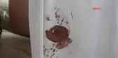 Erzurum Silah 'Öldürmeye Elverişsiz' Çıkınca Ceza İstemi Düştü