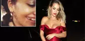Şarkıcı Rita Ora, Taktırdığı Altın Dişleri Takipçilerine Gösterdi